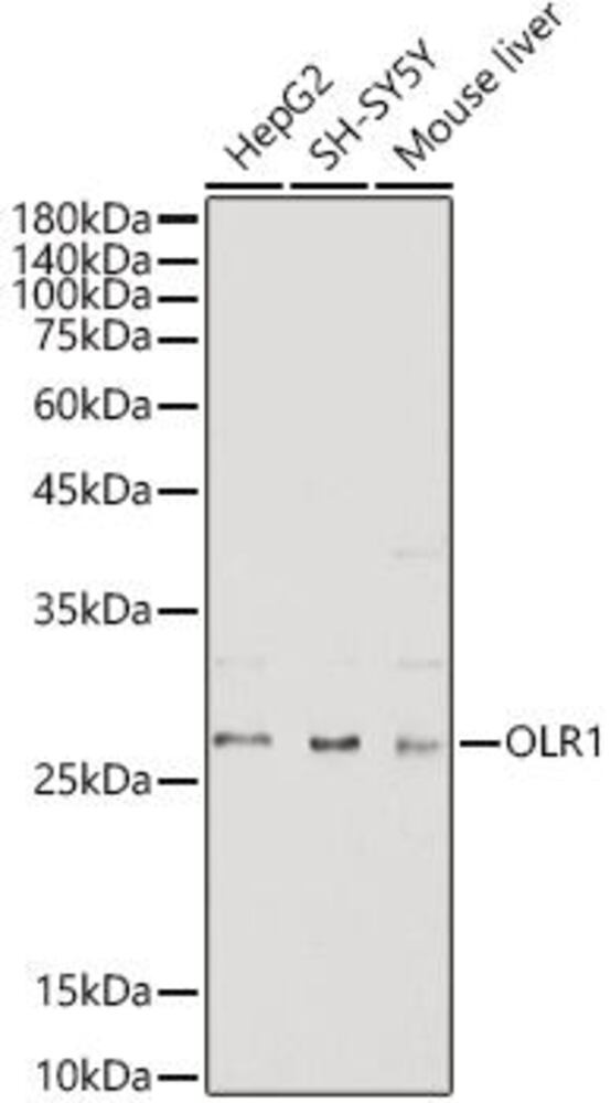 Anti-LOX 1 Antibody, 100 µl - Luminix Health