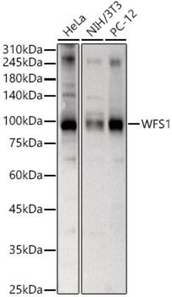 Anti-WFS1 Antibody, 100 µl - Luminix Health