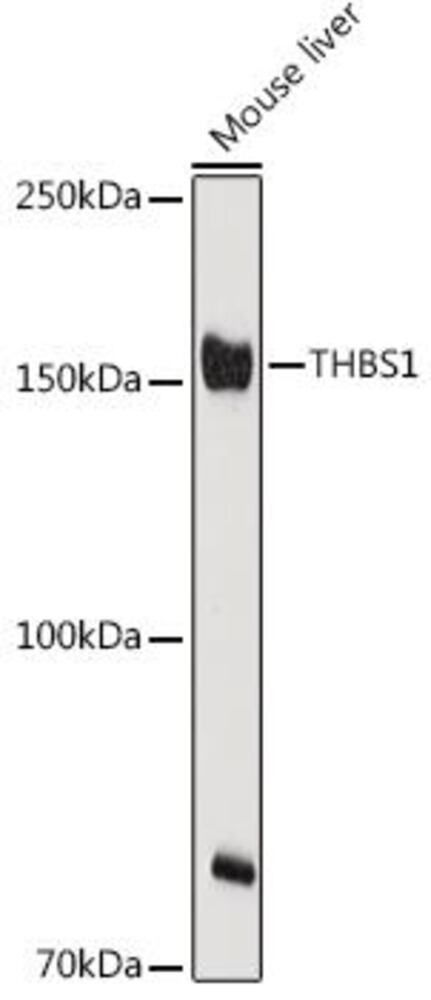 Anti-Thrombospondin 1 Antibody, 100 µl - Luminix Health