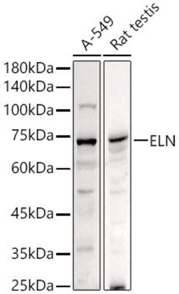 Anti-Elastin Antibody, 100 µl - Luminix Health
