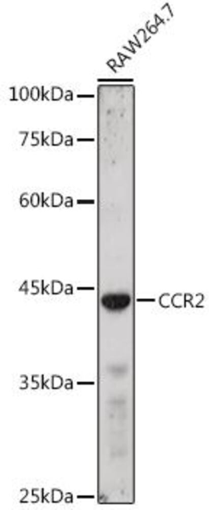 Anti-CCR2 Antibody, 100 µl - Luminix Health