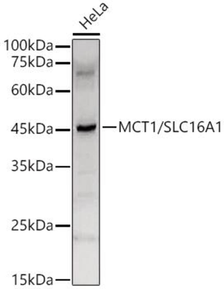 Anti-MCT1 Antibody, 100 µl - Luminix Health