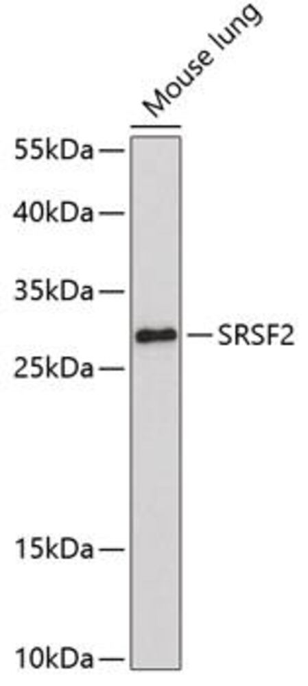 Anti-SC35 Antibody, 100 µl - Luminix Health