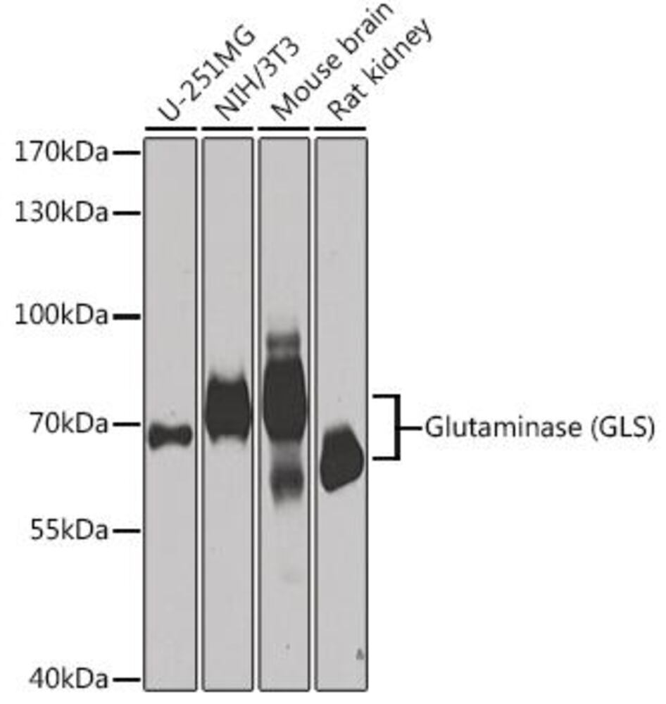 Anti-Glutaminase Antibody, 100 µl - Luminix Health