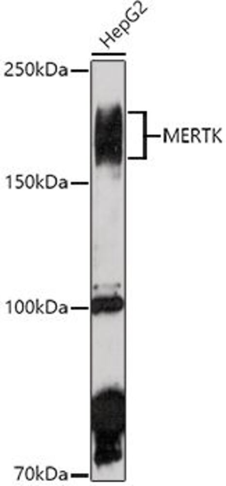 Anti-MERTK Antibody, 100 µl - Luminix Health