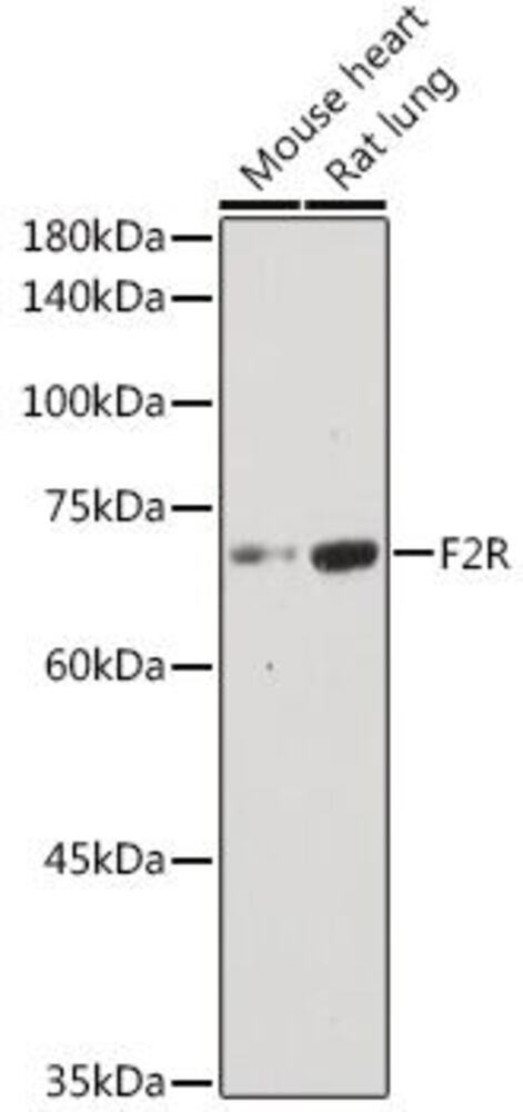 Anti-PAR1 / Thrombin Receptor Antibody, 100 µl - Luminix Health