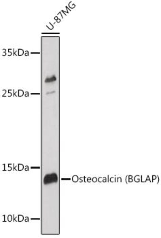 Anti-Osteocalcin Antibody, 100 µl - Luminix Health