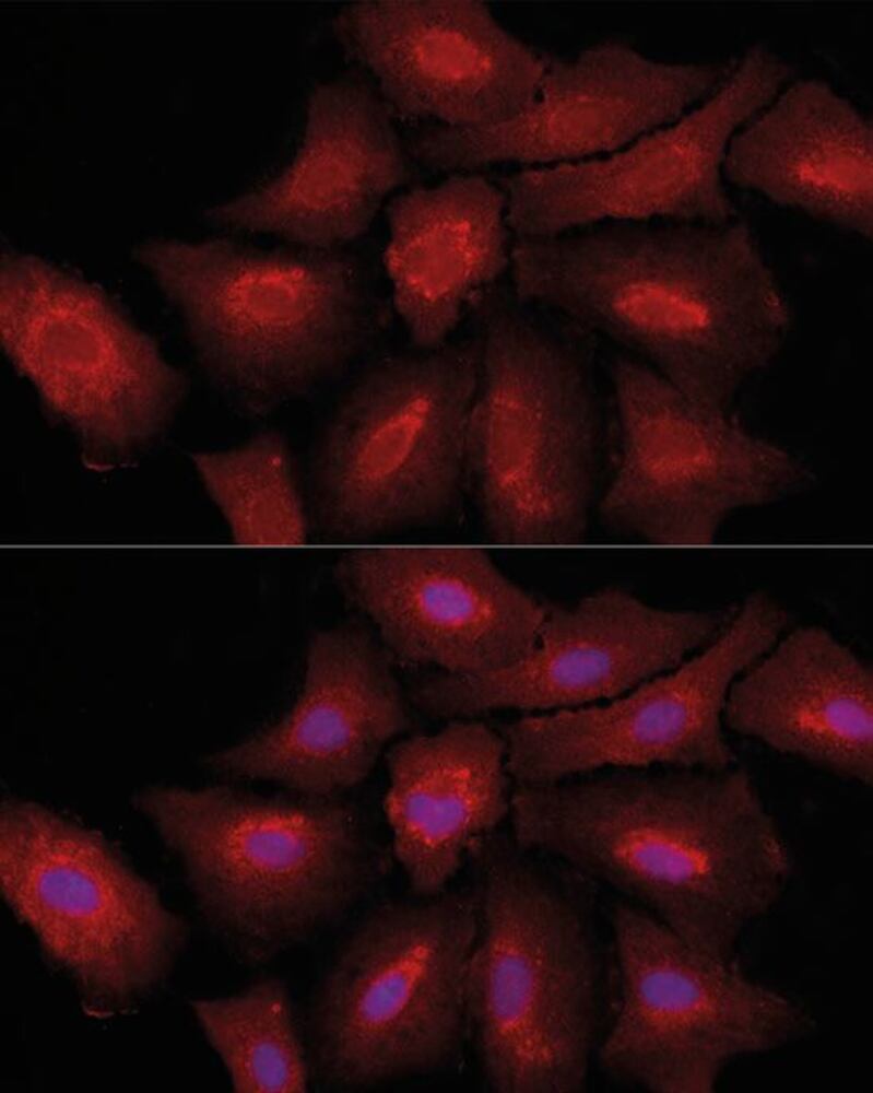 A-Fibroblast activation protein, a Antib, 100 µl - Luminix Health