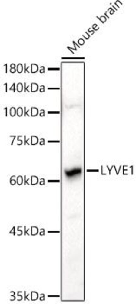 Anti-LYVE1 Antibody, 100 µl - Luminix Health