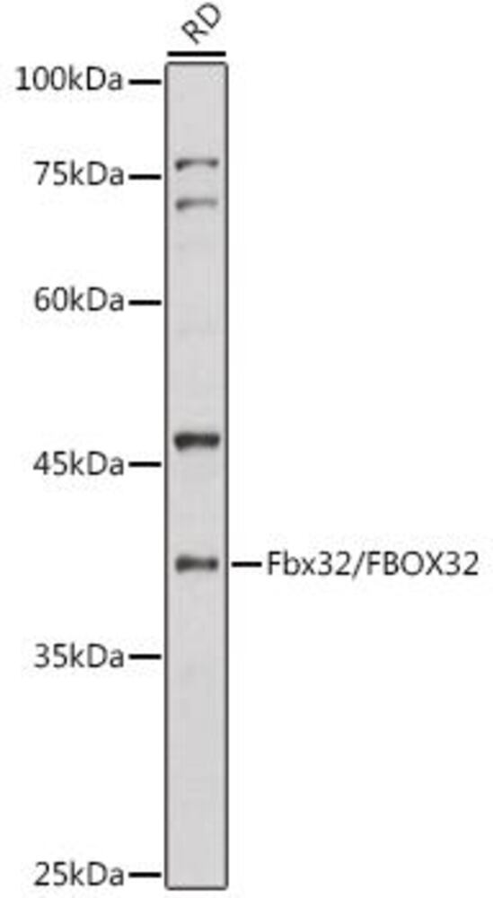 Anti-Fbx32 Antibody, 100 µl - Luminix Health