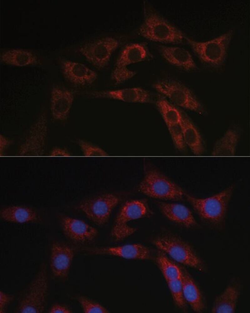 Anti-ABCA1 Antibody, 100 µl - Luminix Health