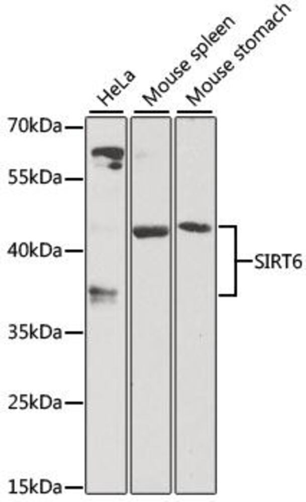 Anti-SIRT6 Antibody, Density (D) 1 g/cm³, Storage temp. +4 °C - Luminix Health