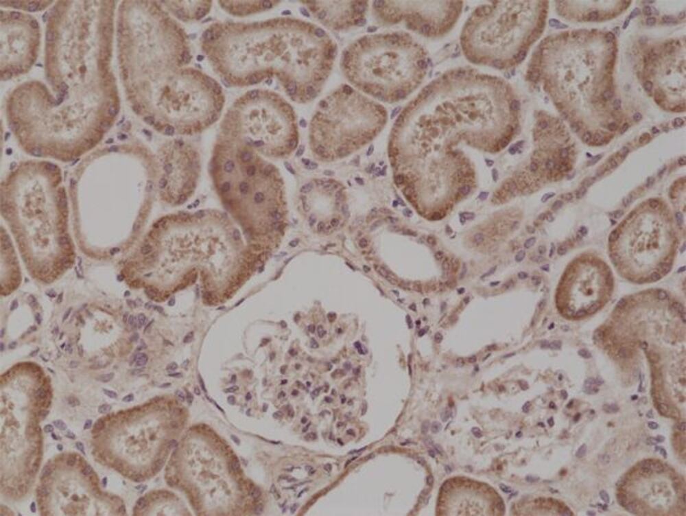 Anti-BRAF Antibody [RM308], 50 µl - Luminix Health