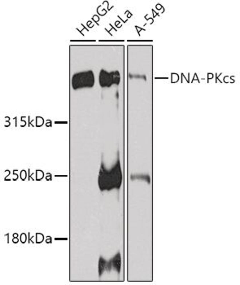 Anti-DNA PKcs Antibody, 100 µl - Luminix Health
