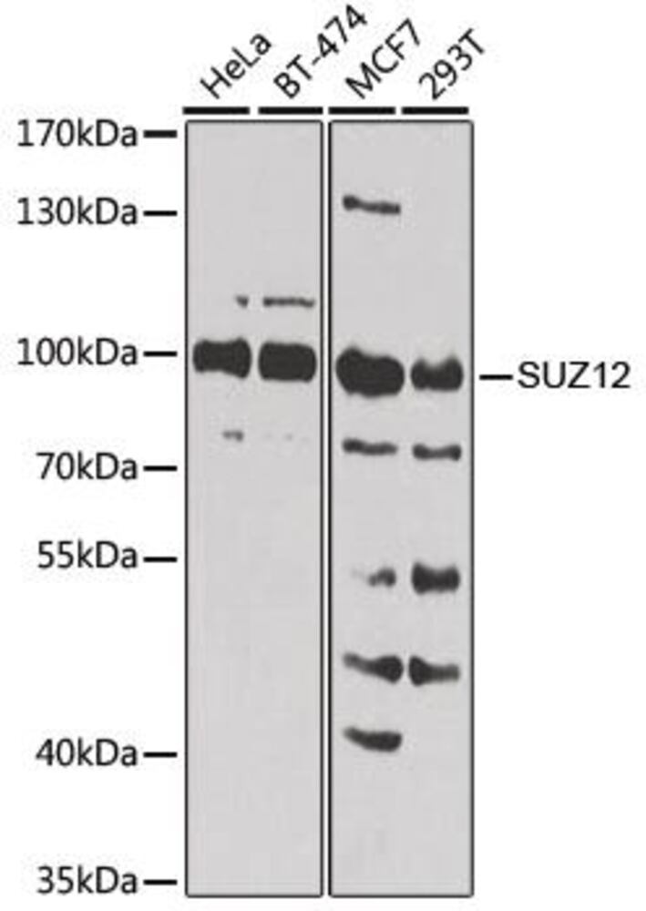 Anti-SUZ12 Antibody, 100 µl - Luminix Health
