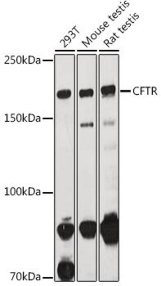 Anti-CFTR Antibody, 100 µl - Luminix Health