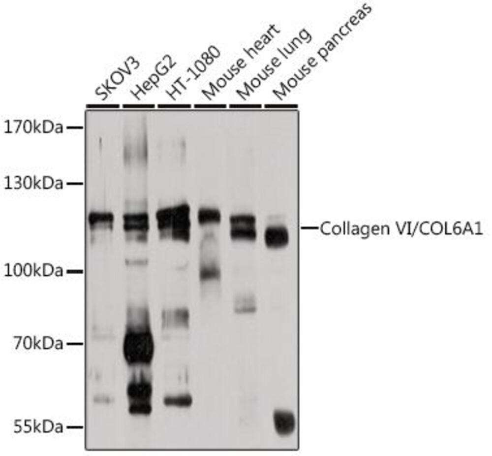 Anti-Collagen VI Antibody, 100 µl - Luminix Health