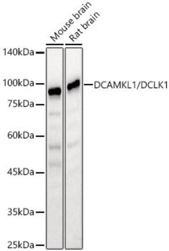 Anti-DCAMKL1 Antibody, 100 µl - Luminix Health
