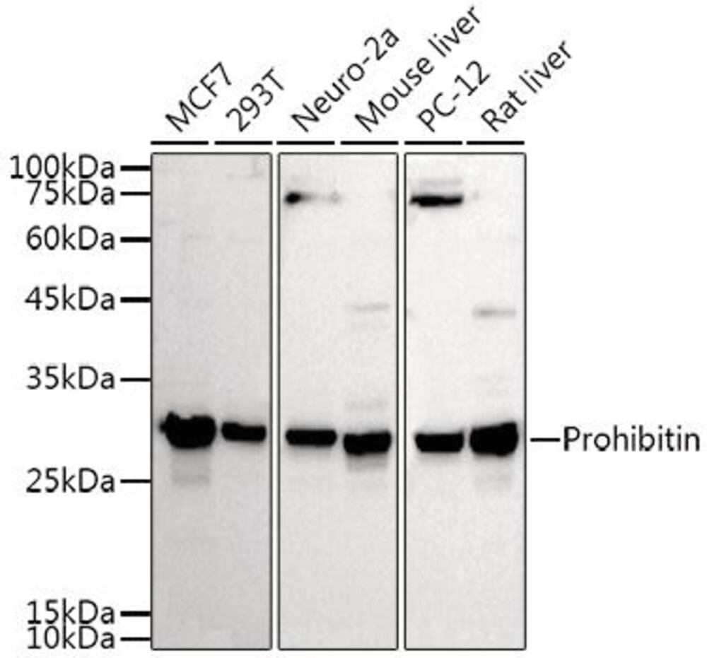 Anti-Prohibitin Antibody, 100 µl - Luminix Health