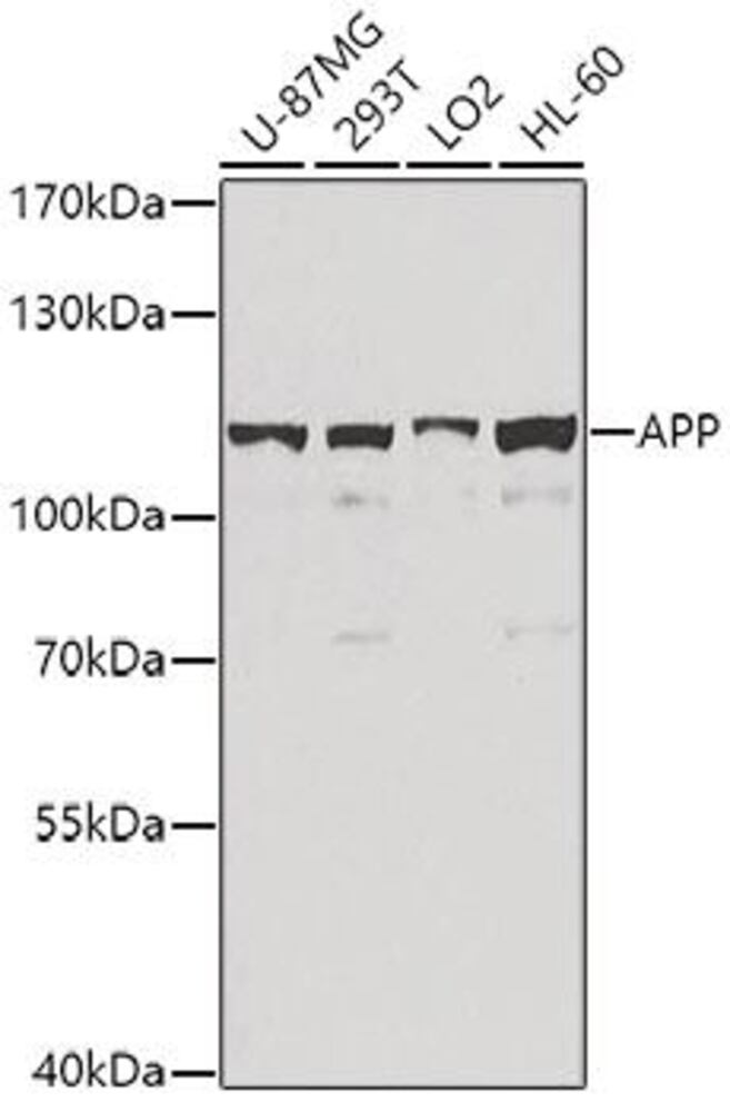 Anti-Amyloid Precursor Protein Antibody - Luminix Health