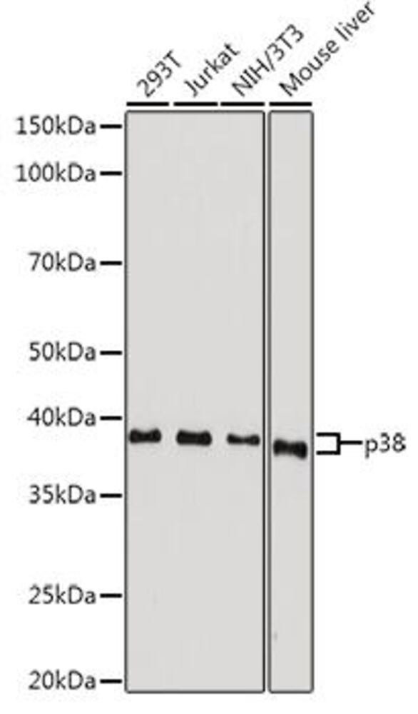 Anti-p38 alpha / MAPK14 Antibody, 100 µl - Luminix Health