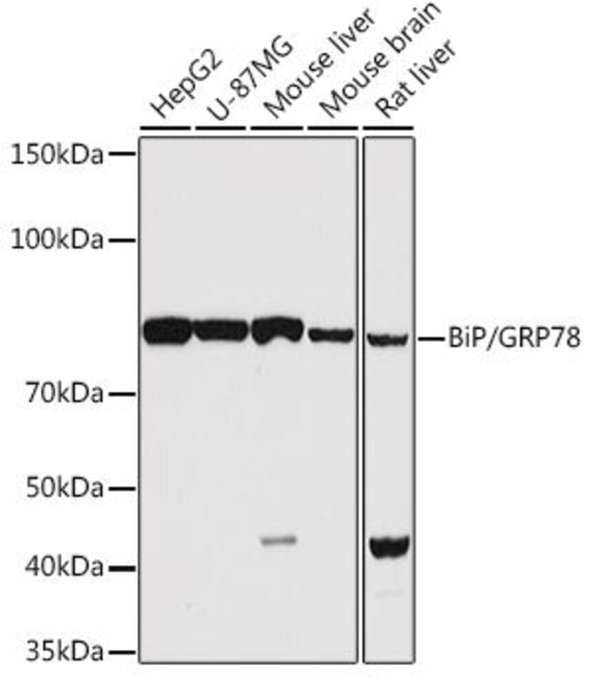 Anti-GRP78 BiP Antibody, 100 µl - Luminix Health