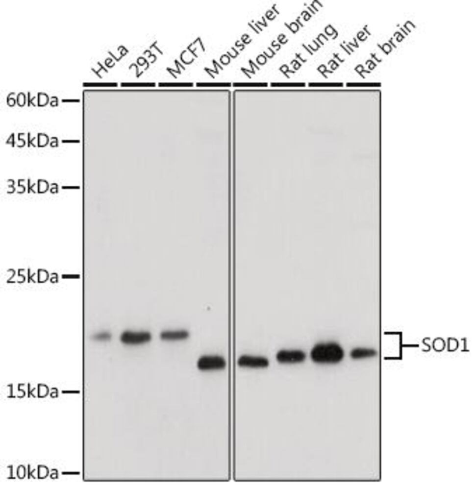 Anti-Superoxide Dismutase 1 Antibody, 100 µl - Luminix Health