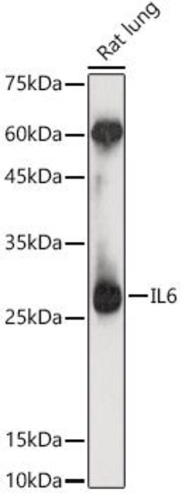 Anti-IL-6 Antibody, 100 µl - Luminix Health