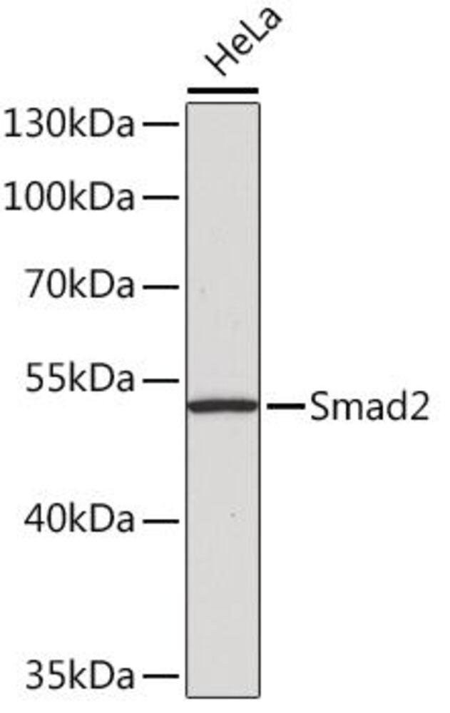 Anti-Smad2 Antibody, Density (D) 1 g/cm³, Storage temp. +4 °C - Luminix Health
