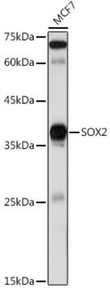 Anti-SOX2 Antibody, Density (D) 1 g/cm³, Storage temp. +4 °C - Luminix Health