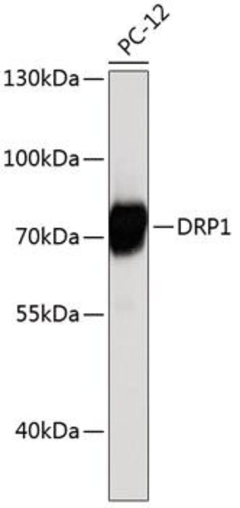 Anti-DRP1 Antibody, 100 µl - Luminix Health