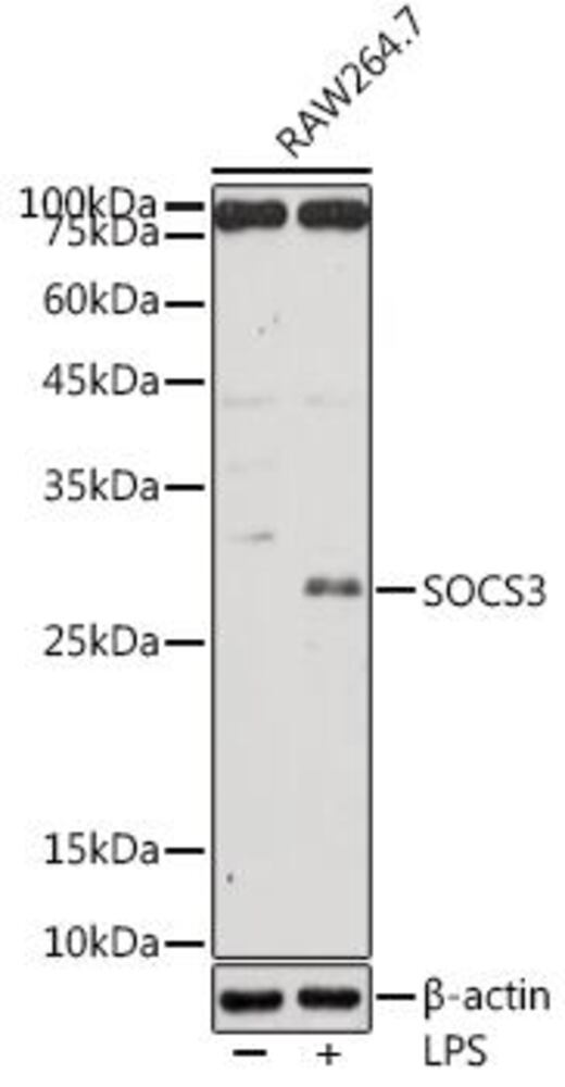 Anti-SOCS3 Antibody, 100 µl - Luminix Health