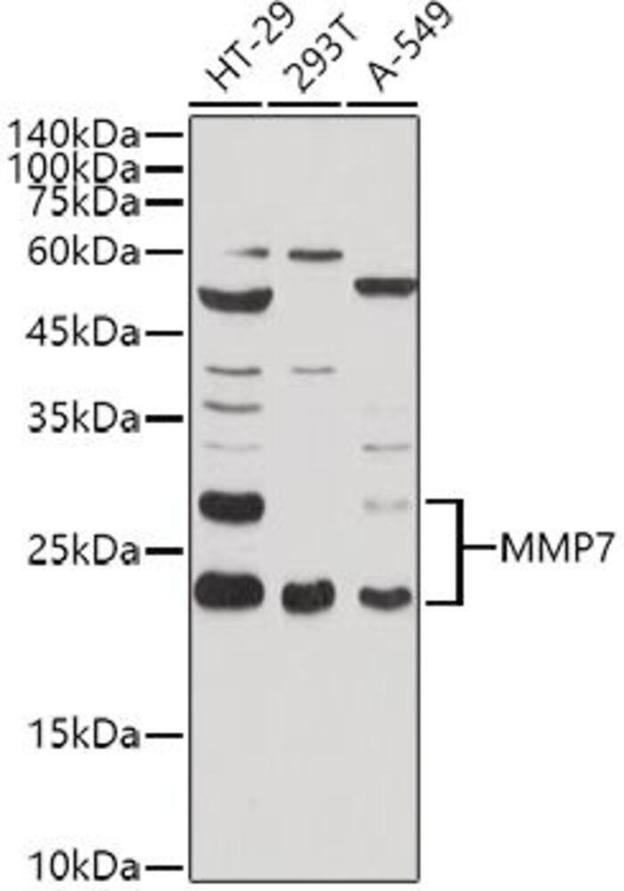 Anti-MMP7 Antibody, 100 µl - Luminix Health