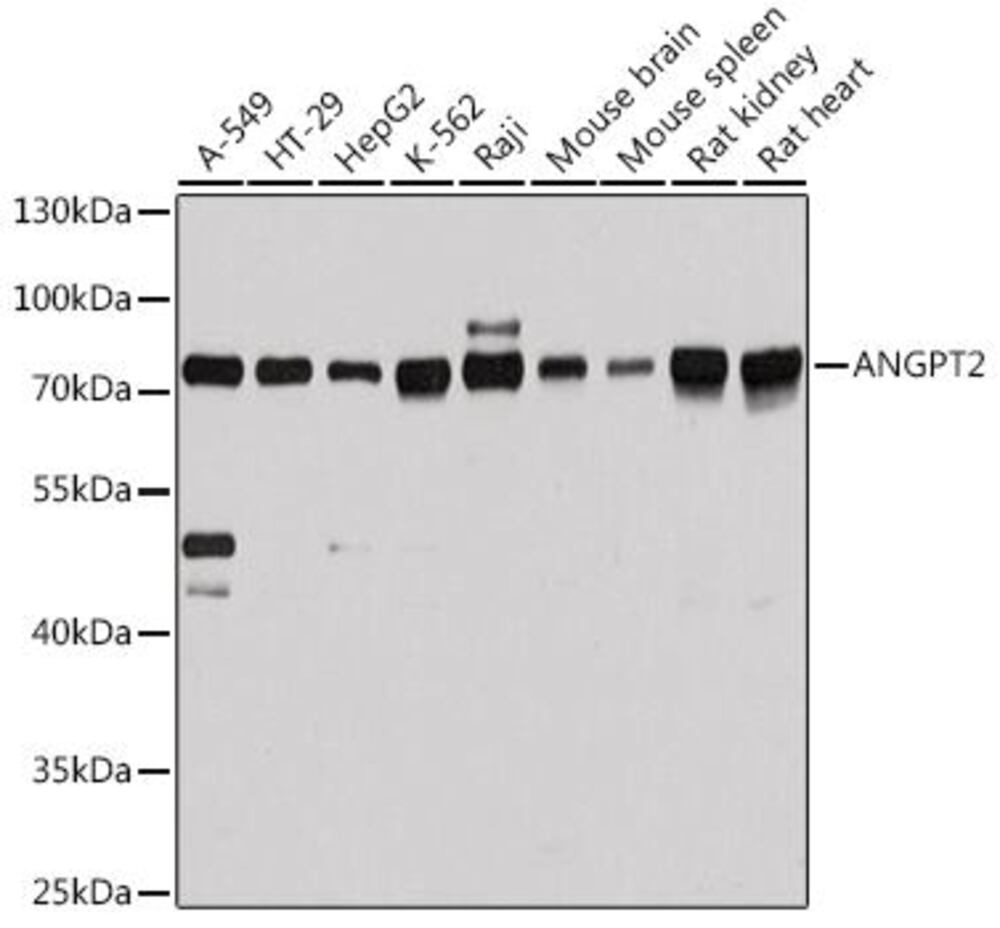 Anti-Angiopoietin 2 / ANG2 Antibody, 100 µl - Luminix Health