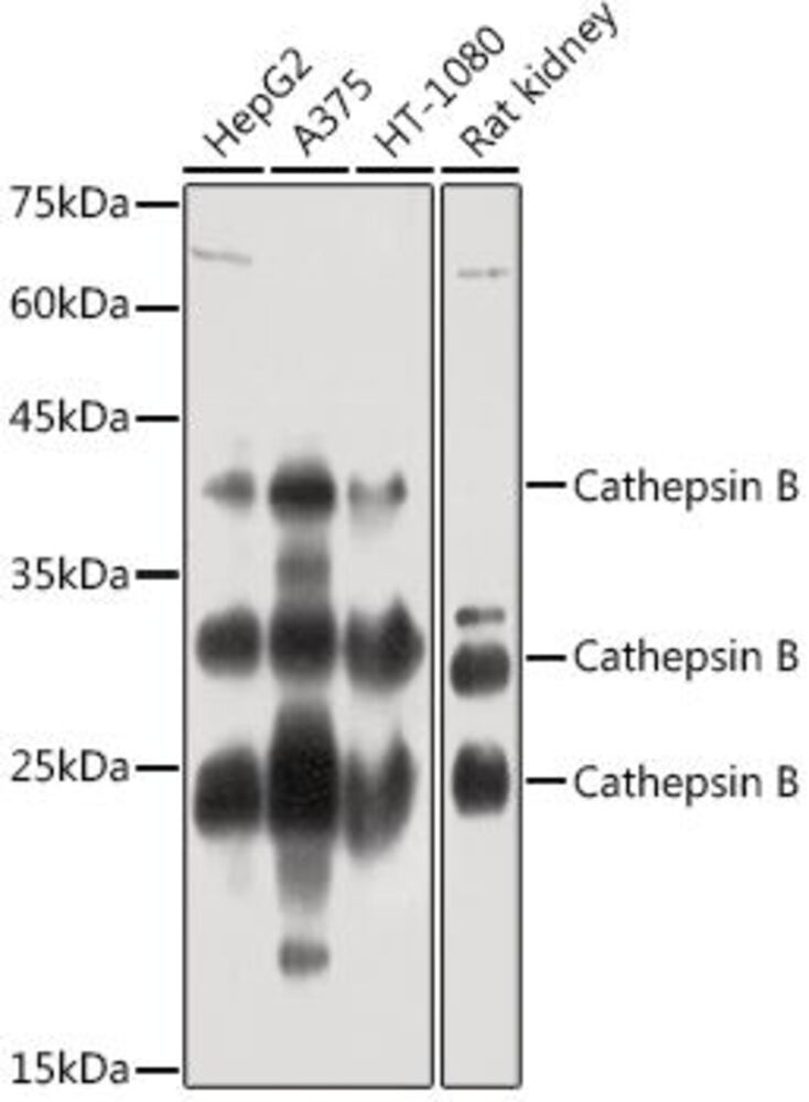 Anti-Cathepsin B Antibody, 100 µl - Luminix Health