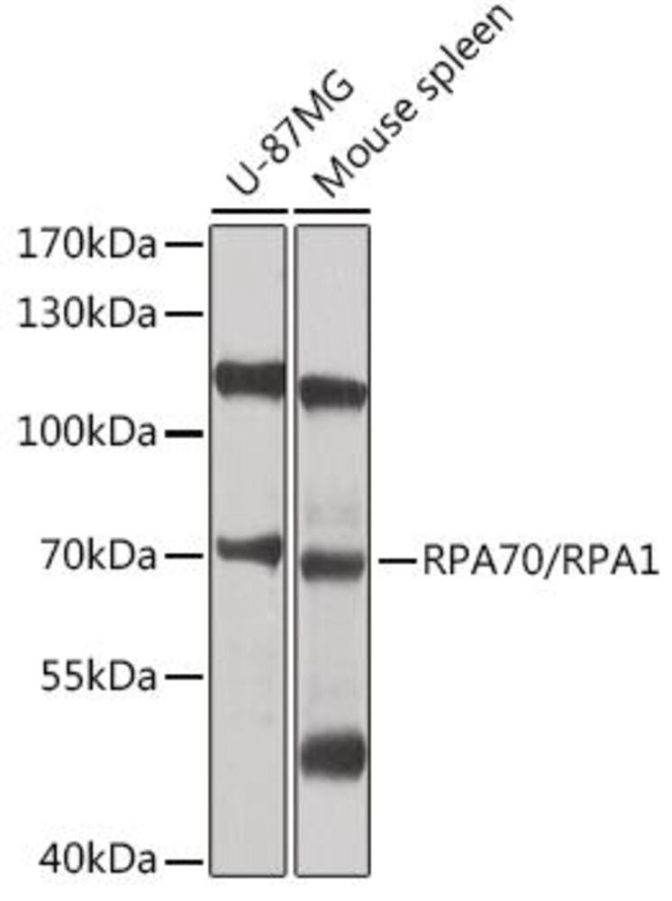 Anti-RPA70 Antibody, 100 µl - Luminix Health