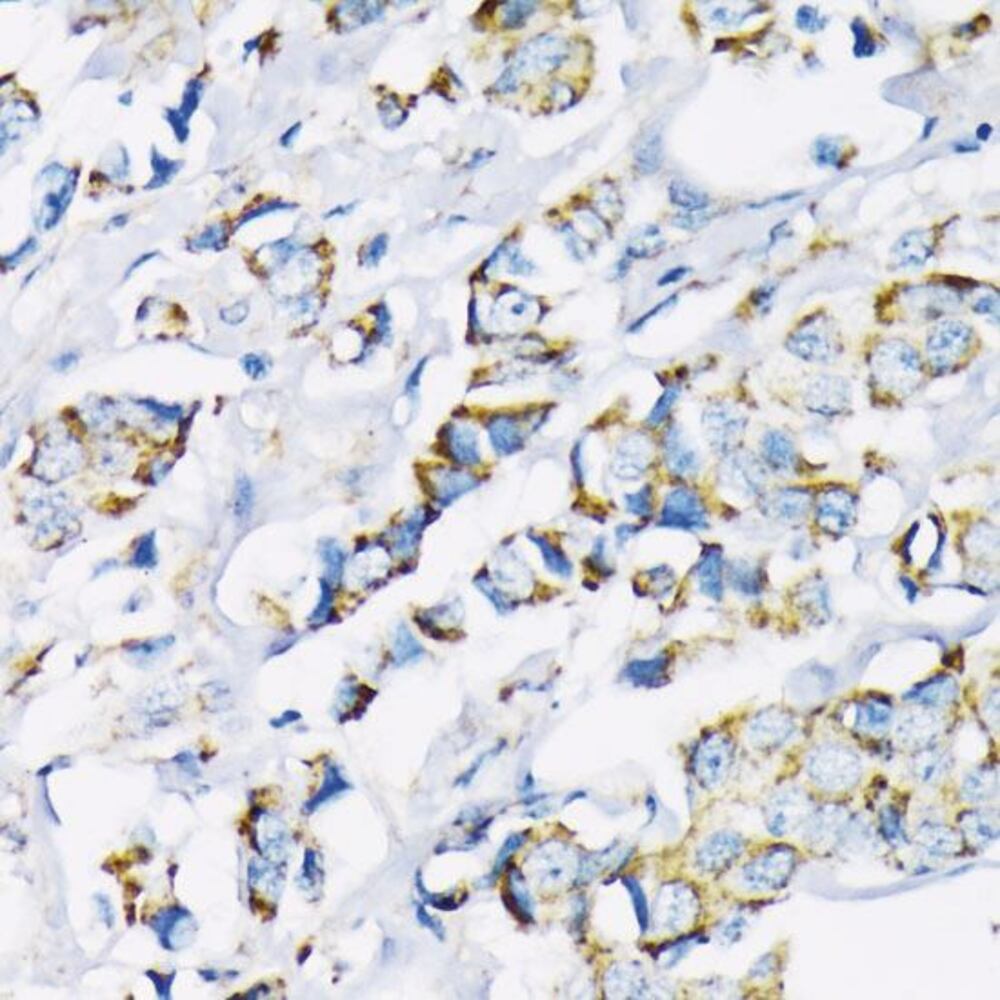 Anti-Hexokinase II Antibody, 100 µl - Luminix Health