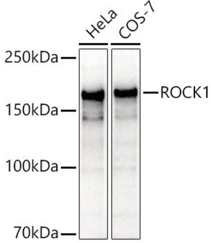 Anti-ROCK1 Antibody, 100 µl - Luminix Health