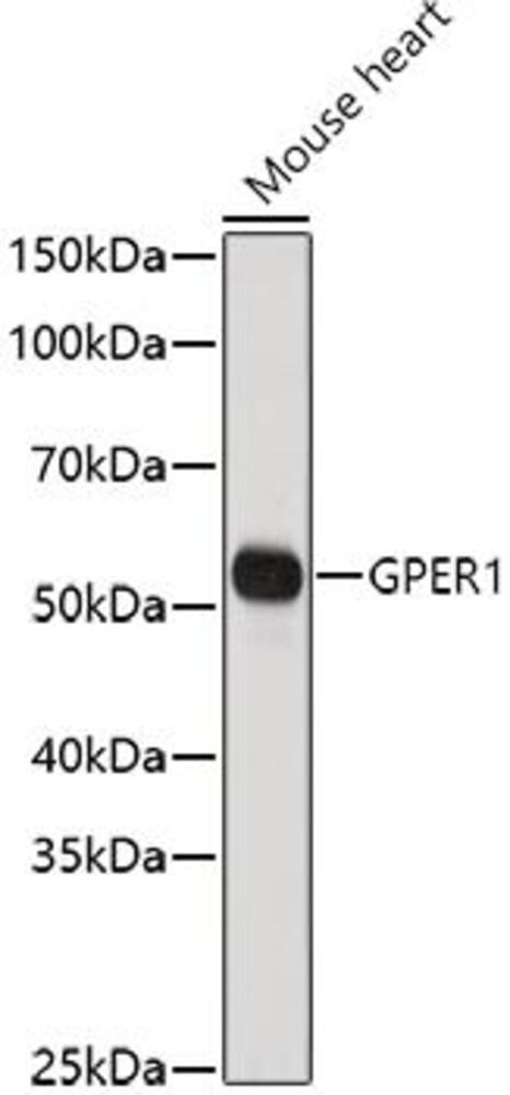 Image of A-G-prot coupled receptor 30 Antib