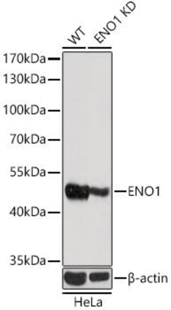 Anti-ENO1 Antibody, Density (D) 1 g/cm³, Storage temp. +4 °C - Luminix Health