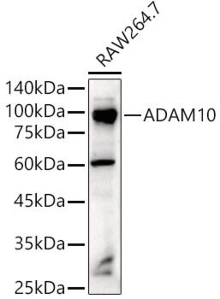 Anti-ADAM10 Antibody, 100 µl - Luminix Health
