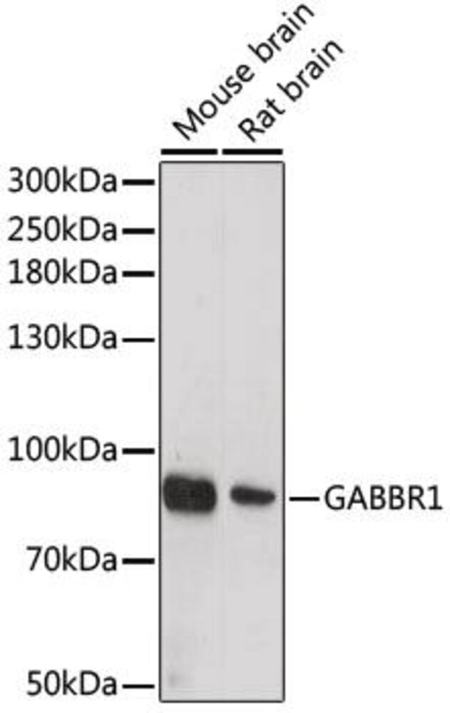Anti-GABA B Receptor 1 Antibody, 100 µl - Luminix Health