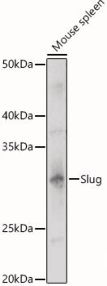 Anti-SLUG Antibody, 100 µl - Luminix Health