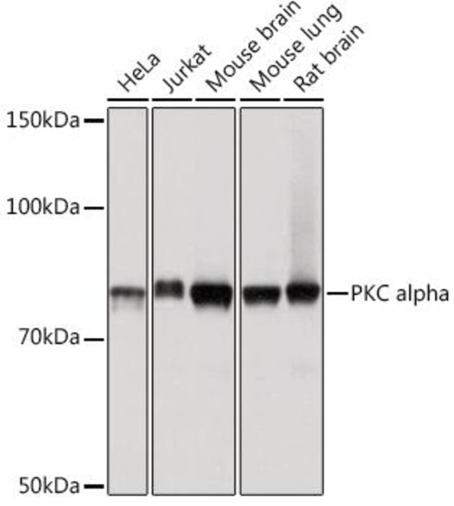 Anti-PKC alpha Antibody [ARC0197], 100 µl - Luminix Health