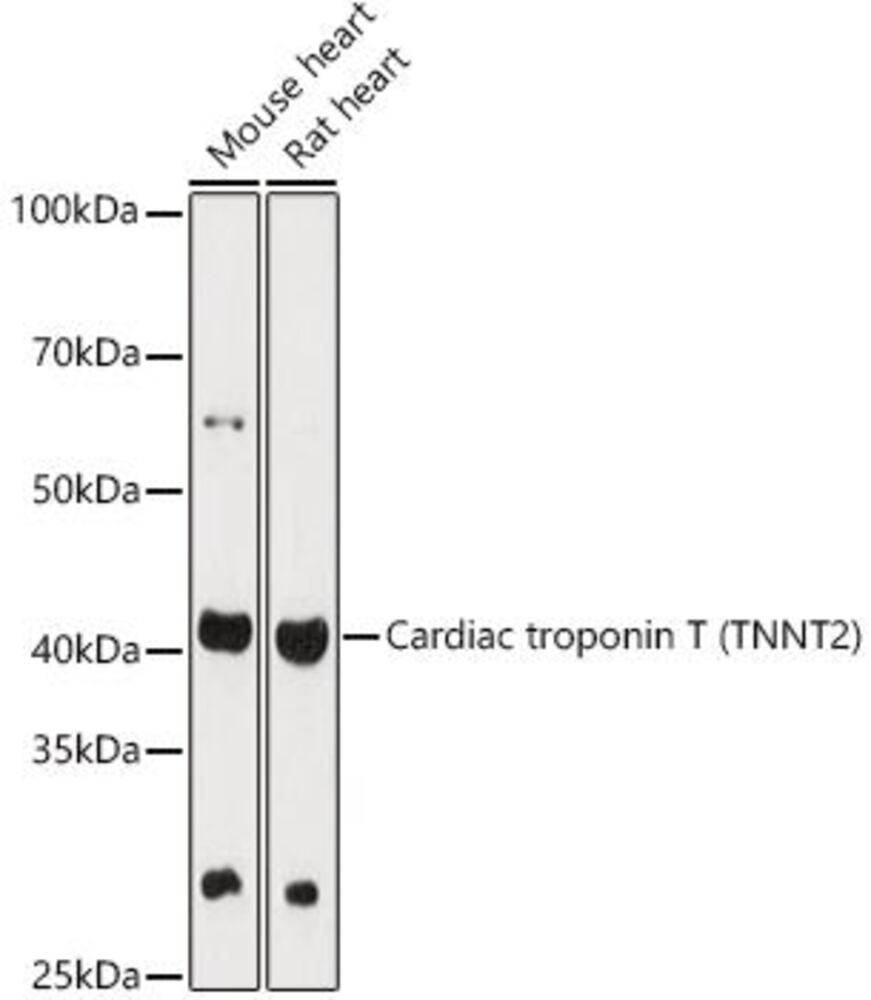 Anti-Cardiac Troponin T Antibody, 100 µl - Luminix Health