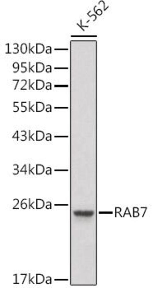 Anti-RAB7 Antibody, 100 µl - Luminix Health