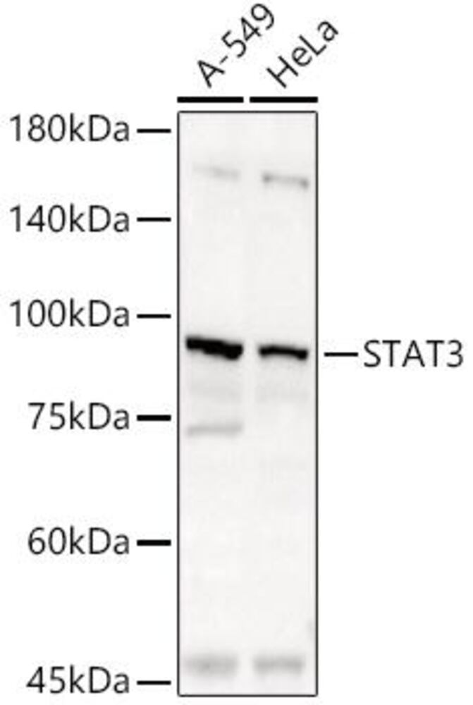 Anti-STAT3 Antibody, 100 µl - Luminix Health