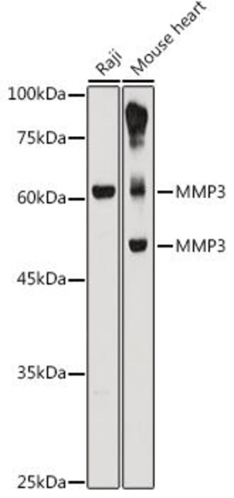 Anti-MMP3 Antibody, 100 µl - Luminix Health