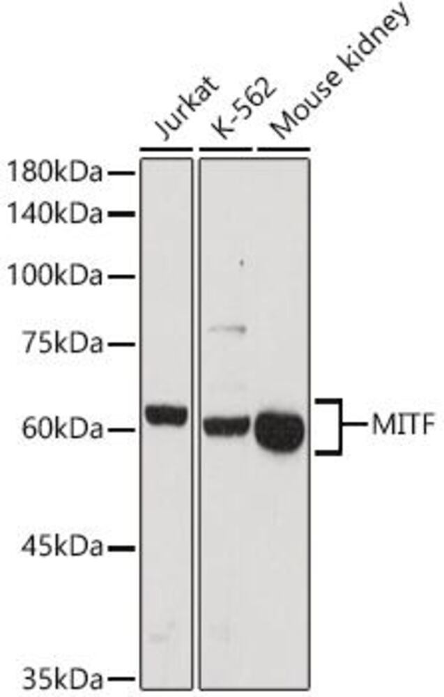 Anti-MiTF Antibody, 100 µl - Luminix Health