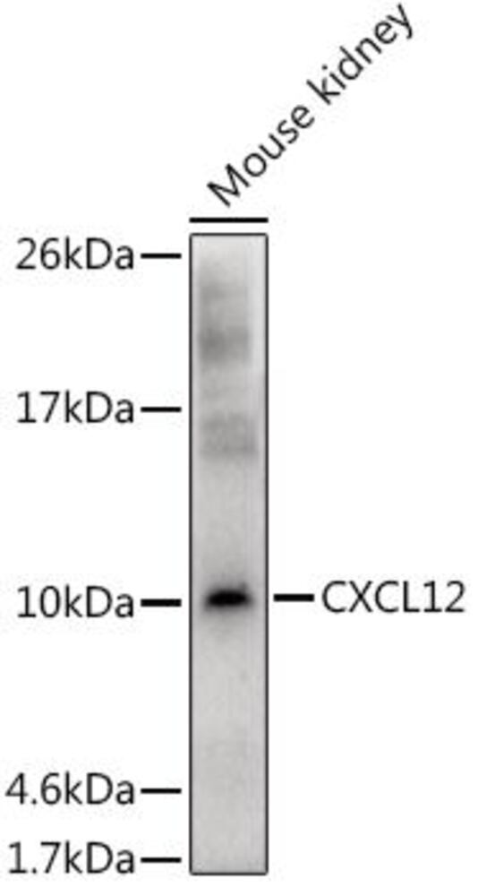 Anti-SDF1 Antibody, Density (D) 1 g/cm³, Storage temp. +4 °C - Luminix Health